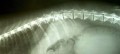 Myelografick vyeten ptenho kanlu